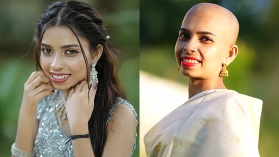 Renu Sudhi revealed a few days ago that she would be undergoing chemotherapy for the fifth time.