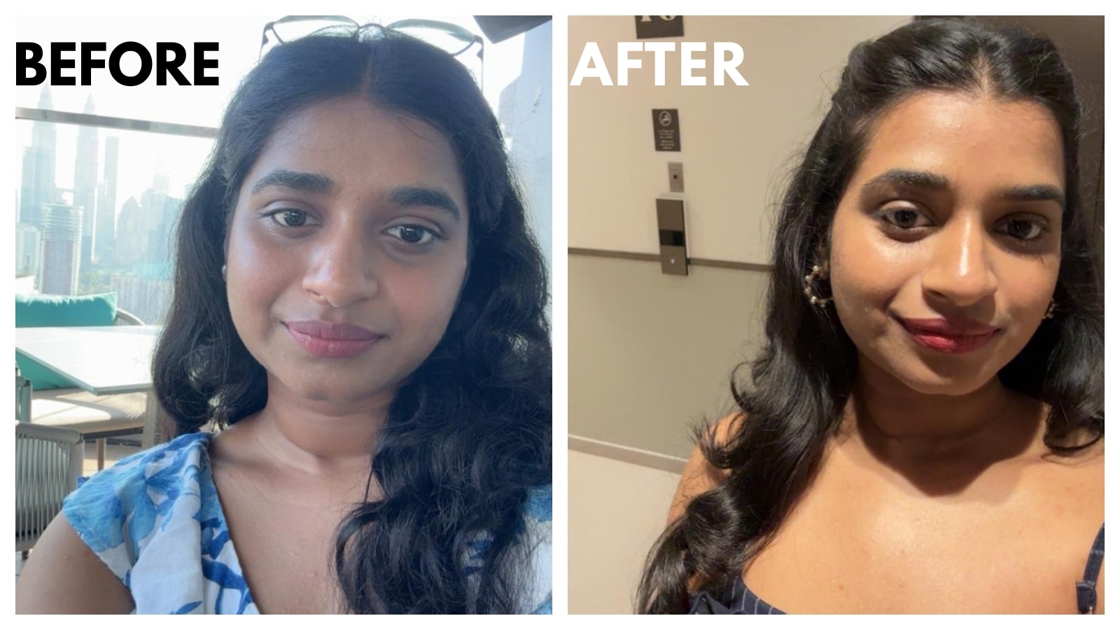 Can a supplement be FDA-approved? Why do doctors not believe in supplements? (Sravya and Dr Sowmya)