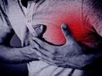 High levels of bad cholesterol cause a heart attack, but sometimes even with healthy cholesterol level people can get heart attack. 