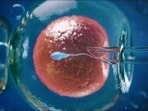 Self-cycle IVF: Fertility expert explains what donor cycle IVF is, and who benefits from it