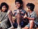 Malnutrition 