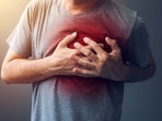 Cardiac arrest
