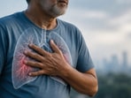 Breathlessness and dry cough, often ignored, may signal interstitial lung disease (ILD). 