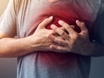 Cardiac arrest (Picture for representation)