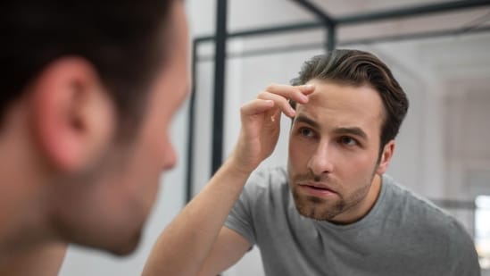 National Hair Day: Why are men experiencing hair loss in their 20s and 30s? (Magnific)
