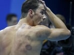 Michael Phelps is seen with red cupping marks on his shoulder as he competes in Rio Olympics. (Reuters)