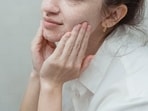 Washing the face the wrong way does not help solve breakouts, shares Chandrika Mahendra.