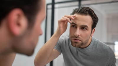 Read more to find out what to consider before getting a hair transplant. (Magnific)
