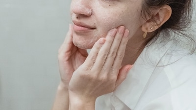 Washing the face the wrong way does not help solve breakouts, shares Chandrika Mahendra. (Pexel) Washing the face the wrong way does not help solve breakouts, shares Chandrika Mahendra. (Pexel)