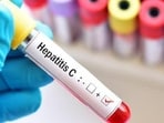 The five-hospital trial has found the eight-week drug combination almost as effective as standard 12-week course. (For representation) The five-hospital trial has found the eight-week drug combination almost as effective as standard 12-week course. (For representation)