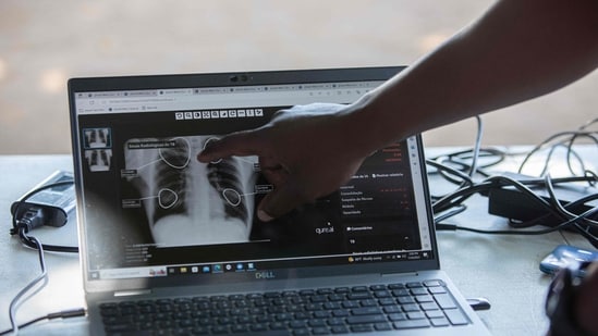 Health screening(AFP)