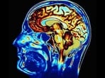 Human-brain