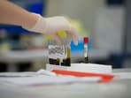 Read more to check out the blood tests recommended by dietician Nikita Bardia.