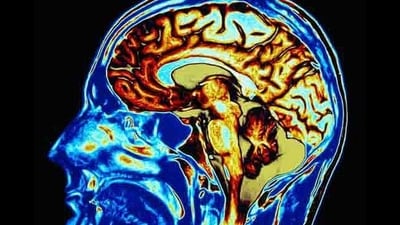 Human-brain Human-brain