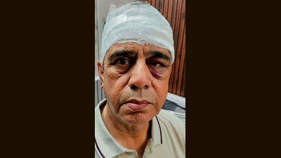 Victim Mohinder Kumar Sharda in Ludhiana on Monday. (HT Photo) Victim Mohinder Kumar Sharda in Ludhiana on Monday. (HT Photo)