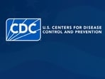 The CDC issued a statement on the reported death amid a suspected pneumonic plague case in Russia. The CDC issued a statement on the reported death amid a suspected pneumonic plague case in Russia.