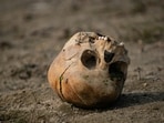 A piece of skull, believed to be human, was found close to where Nancy Guthrie was reportedly kidnapped from. Image for representational purposes.