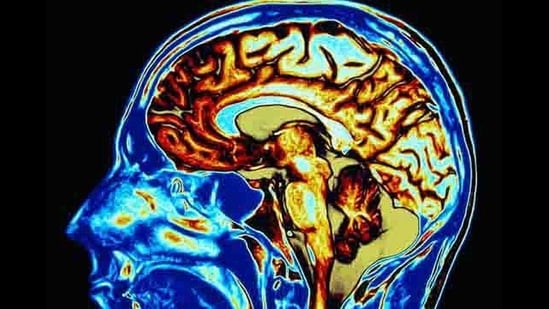Human-brain