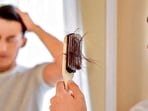 Hair loss in young men can have physical and emotional consequences.