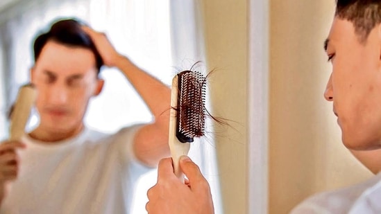 Hair loss in young men can have physical and emotional consequences.
