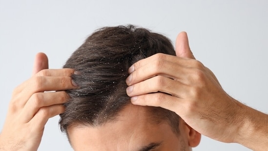 Your scalp health determines your hair health.