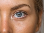 Not all eye conditions start with loss of vision. 