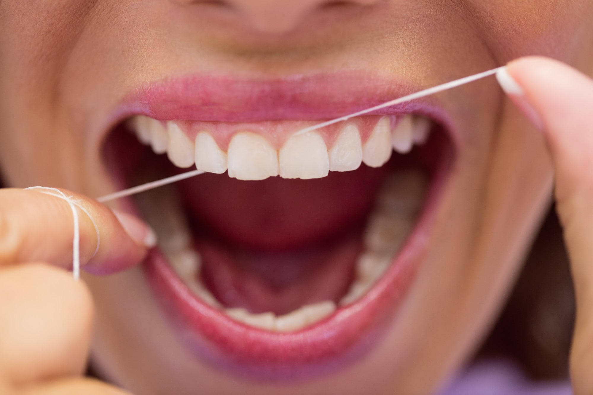 While traditional floss physically removes plaque from tight spaces, water flossers use a stream of water to clean along the gumline and may be more helpful for people with braces, bridges or limited dexterity. (Freepik) While traditional floss physically removes plaque from tight spaces, water flossers use a stream of water to clean along the gumline and may be more helpful for people with braces, bridges or limited dexterity. (Freepik)