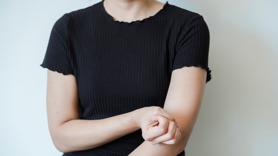 Read more to find out five symptoms of chronic spontaneous urticaria. (Pexel)