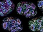 The Supreme Court has allowed existing autism patients to continue stem cell therapy temporarily
