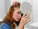 Hair loss is a common side effect of menopause.