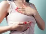 Breast cancer usually results from a combination of factors rather than a single identifiable cause, says Dr Sen. 