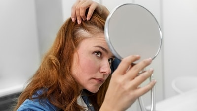Hair loss is a common side effect of menopause. Hair loss is a common side effect of menopause.