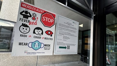 A measles alert sign hangs outside the entrance to the Cohen Children's Medical Center in New Hyde Park, New York in March 2025. (Representational)