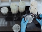 Bacteria that causes deadly Legionnaires’ disease discovered at LA Medical Examiner’s Office, employee tests positive