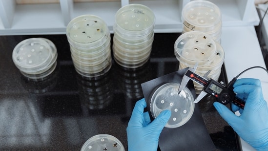 Bacteria that causes deadly Legionnaires’ disease discovered at LA Medical Examiner’s Office, employee tests positive (Pexel - representational image)