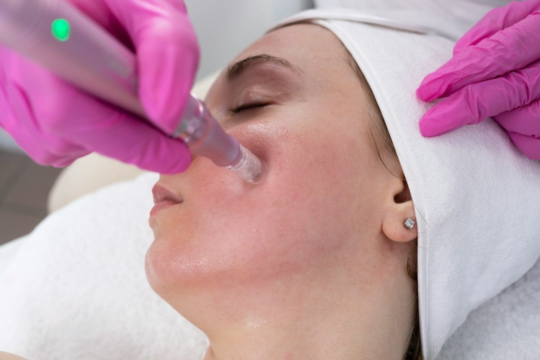 Photo facials are recommended for those looking for a more even-toned complexion. (Unsplash) Photo facials are recommended for those looking for a more even-toned complexion. (Unsplash)