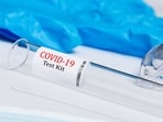 Court documents show that Patel’s laboratory processed polymerase chain reaction (PCR) tests during the COVID-19 pandemic.(Pexel/Representational Image)