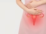 Know diagnosis and treatment of ovarian cysts.