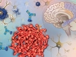 Alzheimer’s disease