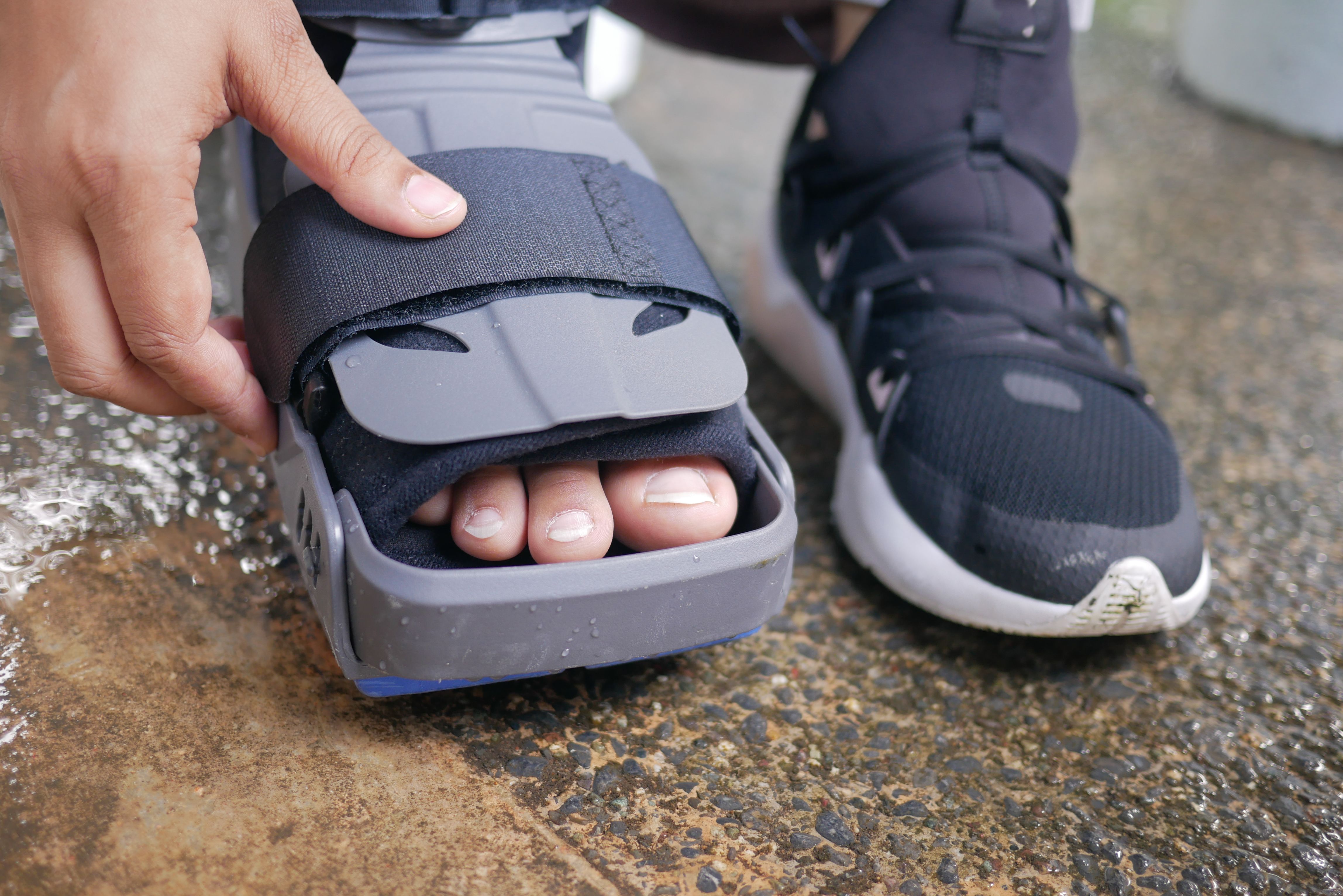 Clinical researcher explains the effect of diabetes on foot health ...
