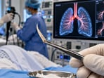 Doctors in Dubai removed a nearly 2cm-long fish bone from an Indian man's airway more than two months after he accidentally inhaled it.