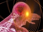 Brain Stroke(Image by Gerd Altmann from Pixabay )