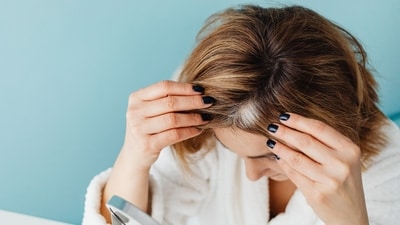 Difference between dry scalp and dandruff. (Pexel) Difference between dry scalp and dandruff. (Pexel)