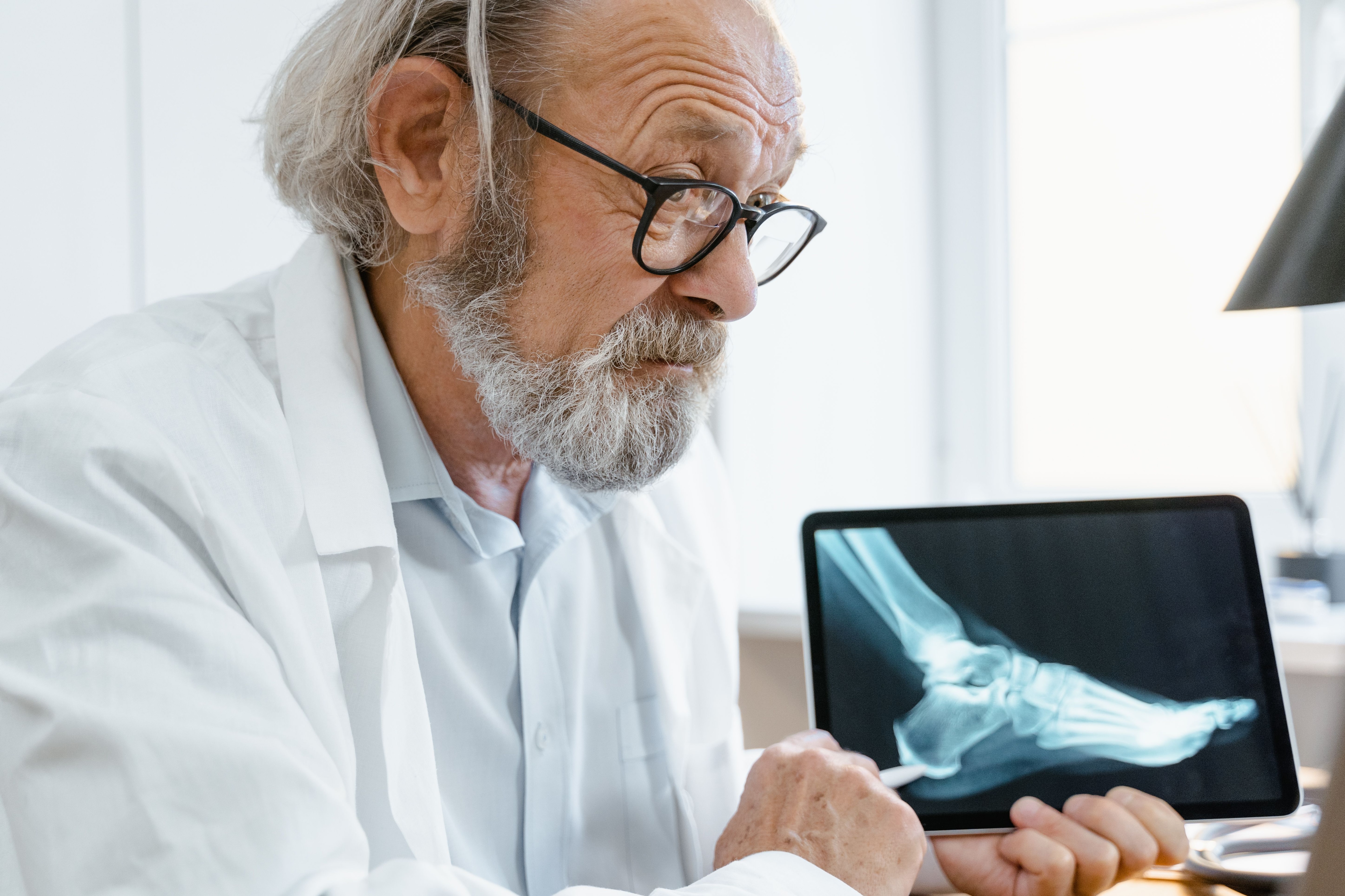 Osteoporosis is what you get when density and quality drop far enough that fractures become likely. (Pexel) Osteoporosis is what you get when density and quality drop far enough that fractures become likely. (Pexel)