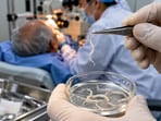 Doctors discovered 11 live worms in the eyes of a South Korean farmer who had visited a hospital for cataract surgery.